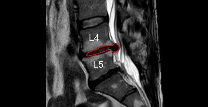 Finansowe aspekty zwolnienia